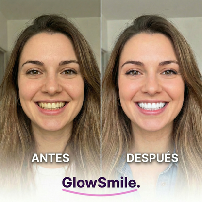 Tiras Blanqueadoras GlowSmile™
