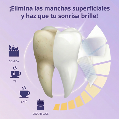 Tiras Blanqueadoras GlowSmile™